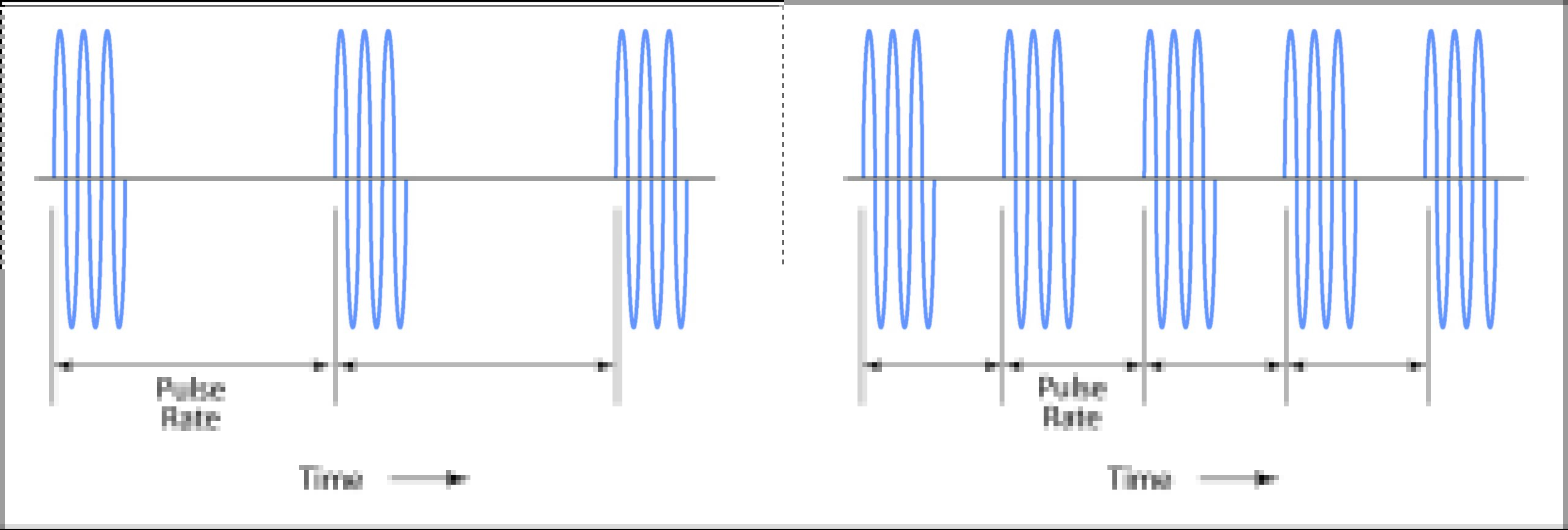 Pulse Rate Illustration showing pulse rate